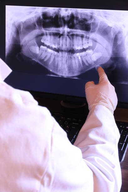 Best Emergency Tooth Extraction in Plain City, OH