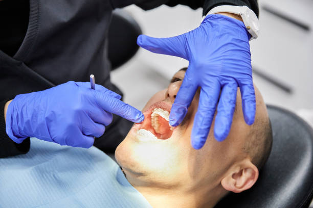 Best Emergency Treatment for Dental Infections or Abscesses in Plain City, OH